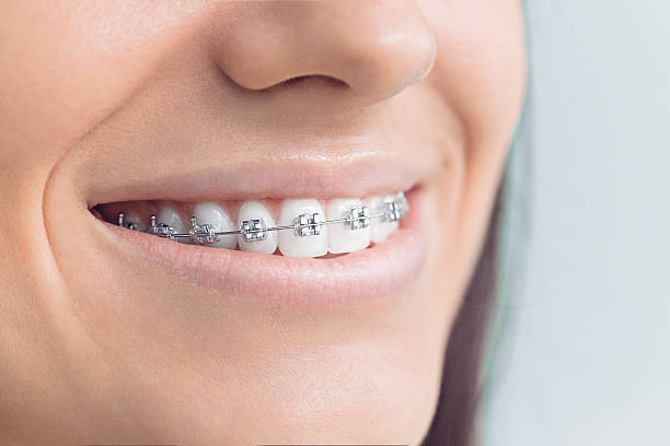 Best Traditional Braces  in Lasalle, IL